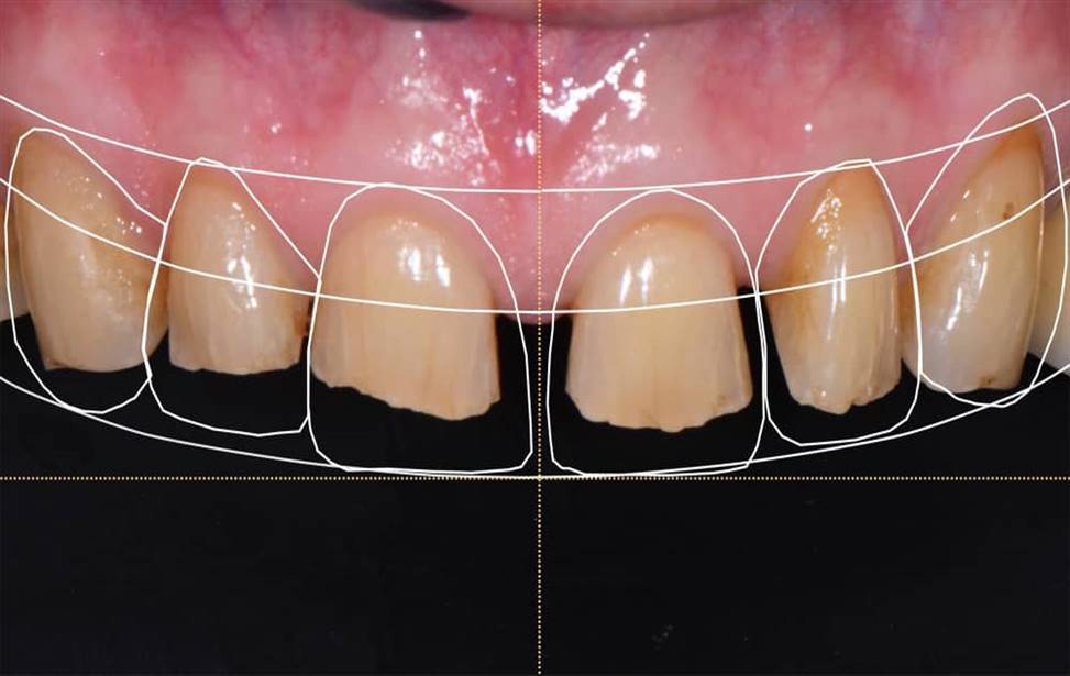 تفاوت دندانپزشکی دیجیتال و سنتی